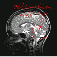 brain_image